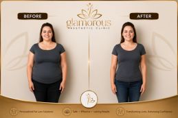 before and after of mounjaro injections result
