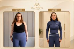 Cost of Weight Loss Injections in Islamabad