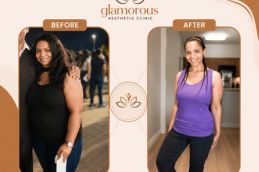 before and after result weight loss in Islamabad Pakistan