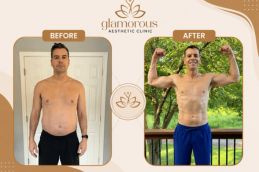 before and after result weight loss in Islamabad Pakistan
