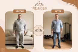 before and after results of weight loss in Islamabad Pakistan