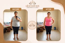 before and after results of weight loss in Islamabad