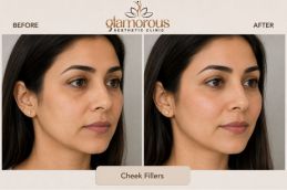 Before and after cosmetic Injectable