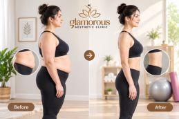 Befor and after Wegovy injection