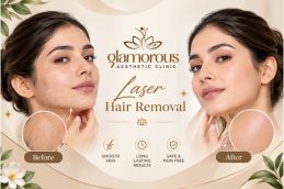 Before and After Results of Laser Hair Removal in Islamabad, Best Before and After Results of Laser Hair Removal in Islamabad