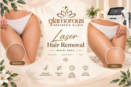 Before and After Results of Laser Hair Removal in Islamabad, Best Before and After Results of Laser Hair Removal in Islamabad