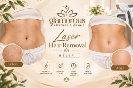 Before and After Results of Laser Hair Removal in Islamabad, Best Before and After Results of Laser Hair Removal in Islamabad