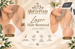 Before and After Results of Laser Hair Removal in Islamabad , Best Before and After Results of Laser Hair Removal in Islamabad