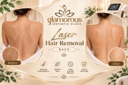 Before and After Results of Laser Hair Removal in Islamabad, Best Before and After Results of Laser Hair Removal in Islamabad