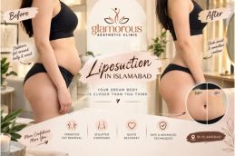 Before and After results of Liposuction in Islamabad, Best Before and After results of Liposuction in Islamabad
