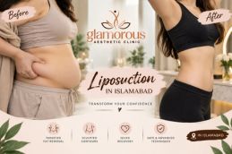 Before and After results of Liposuction in Islamabad , Best Before and After results of Liposuction in Islamabad