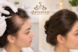 Best Befor and After PRP Hair Treatment in Islamabad (2)