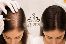 Best Befor and After PRP Hair Treatment in Islamabad (7)