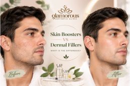 Skin Boosters vs Dermal Fillers What Is the Difference