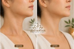 befor and after best result surgical scar on neck