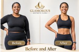 before and after results of ozempic injections in Islamabad pakistan